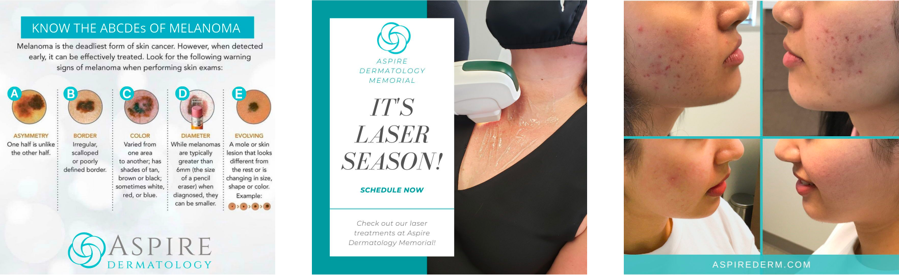 Aspire dermatology web pages pictures